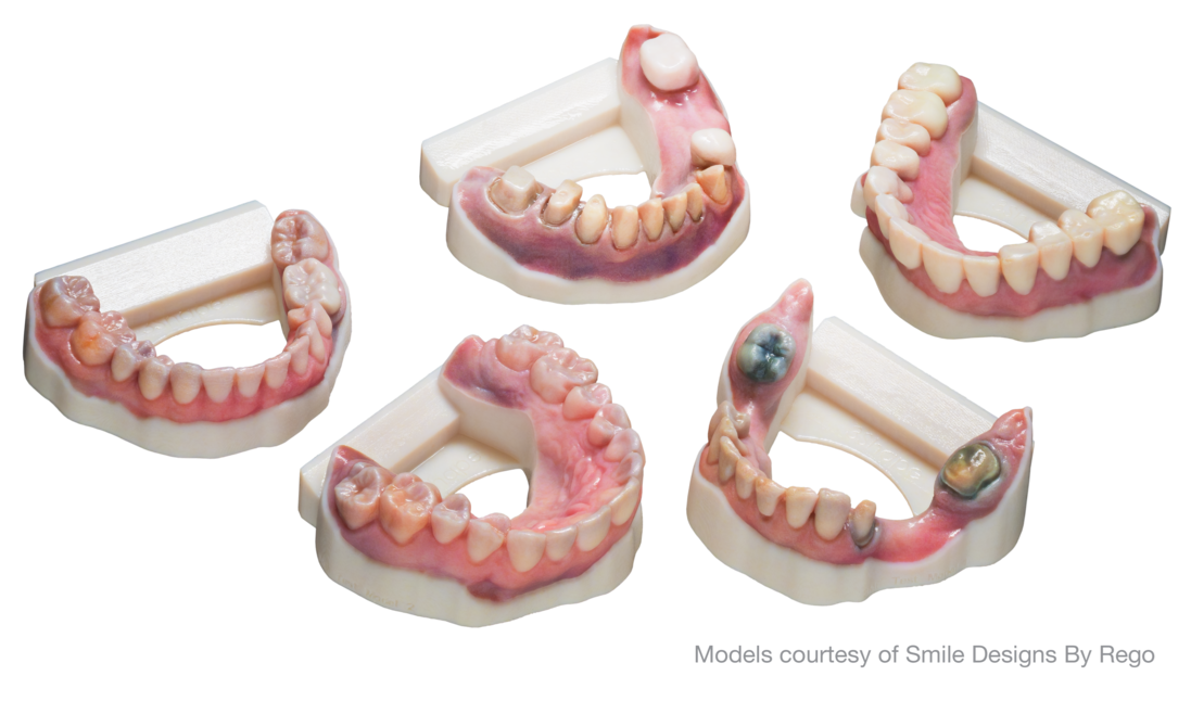 Dental models